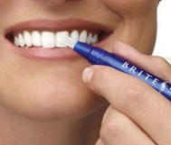 40% discount on dental bleaching