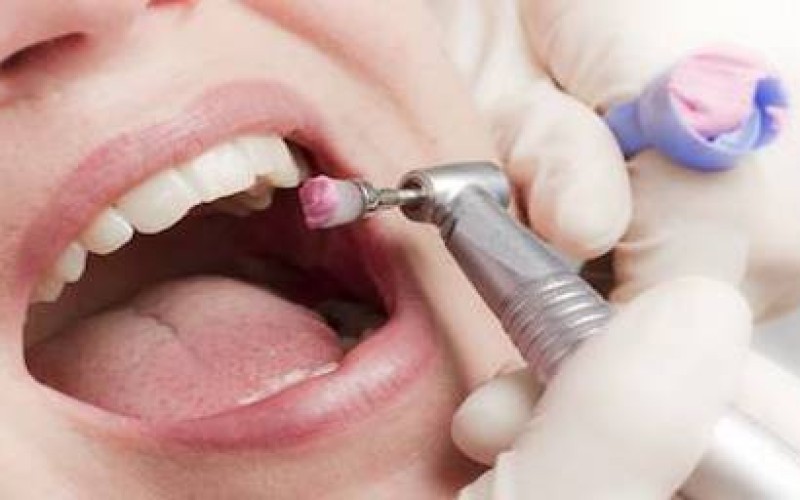 Oral Specialized Complex